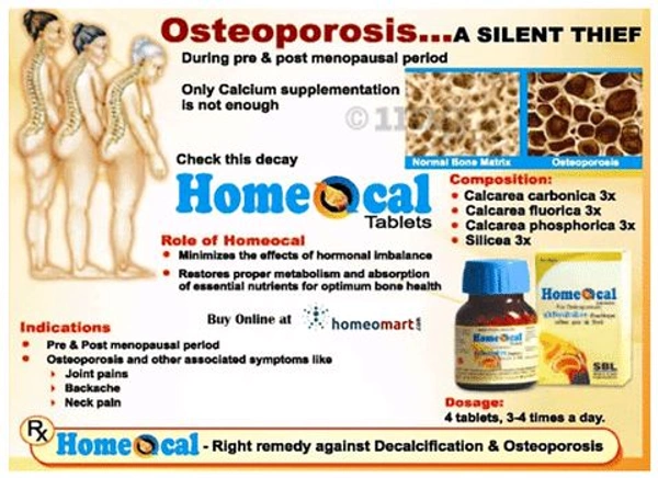 SBL Homeocal Tablets  - 25gm