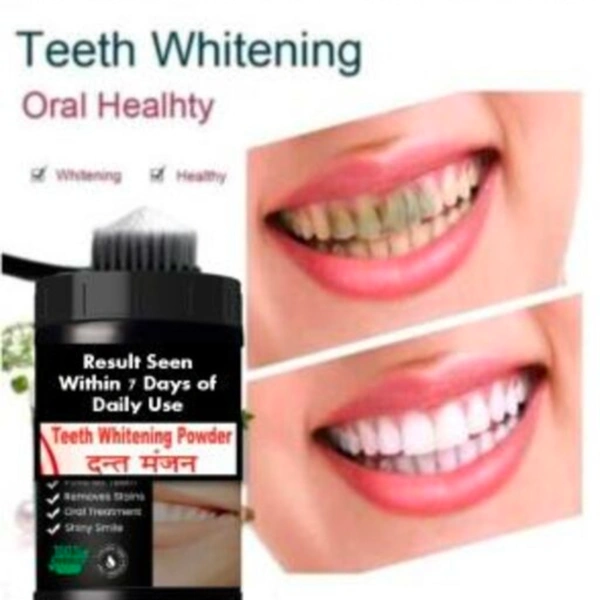 Teeth Whitening