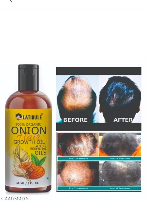 Herbal Hair Oil
