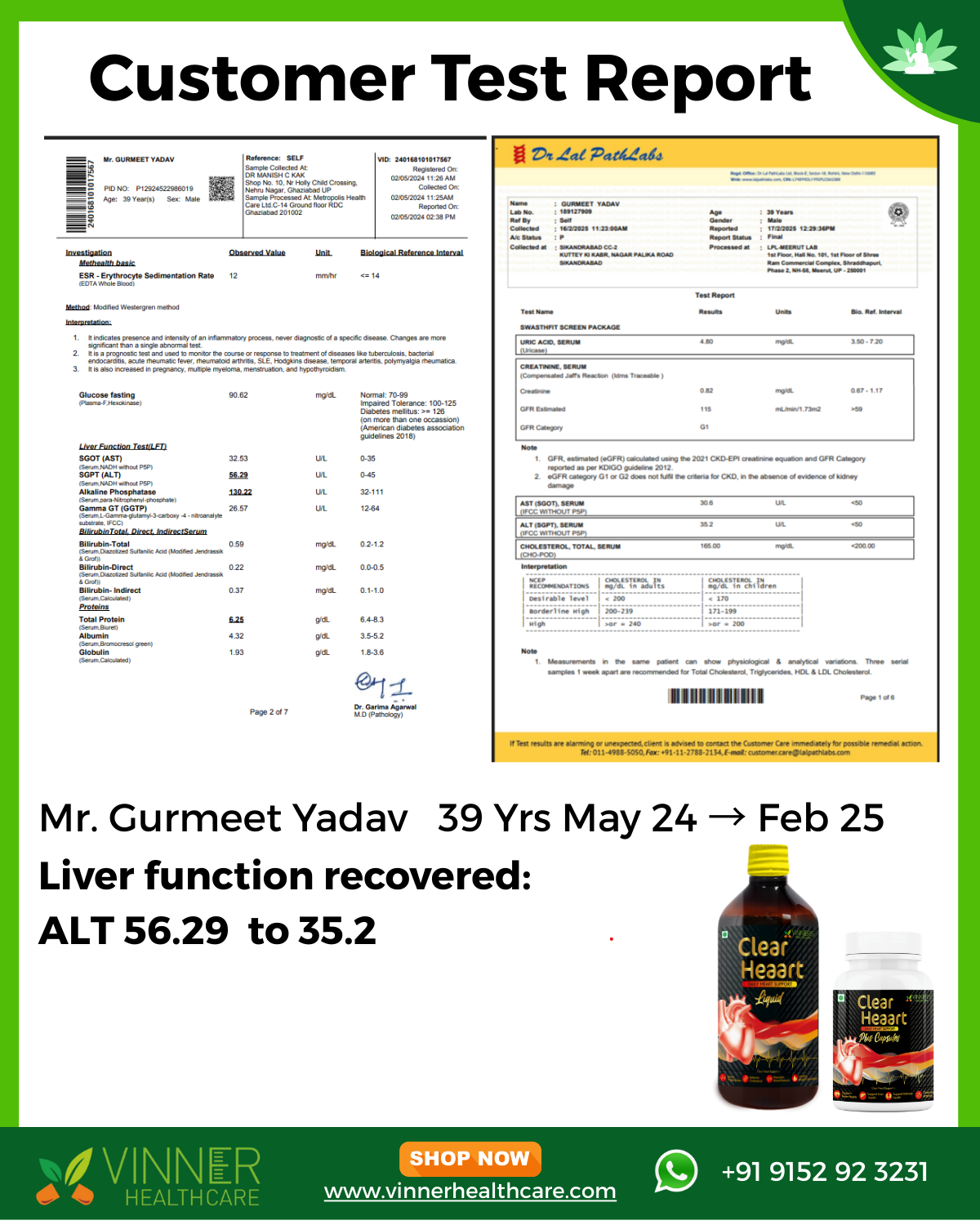 Gurmeet Yadav Lab Report