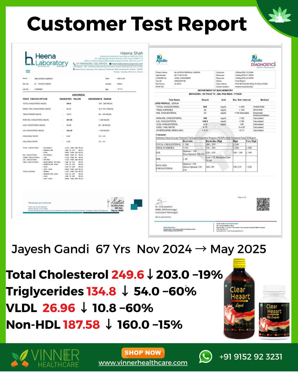 Jayesh Gandhi Lab Report