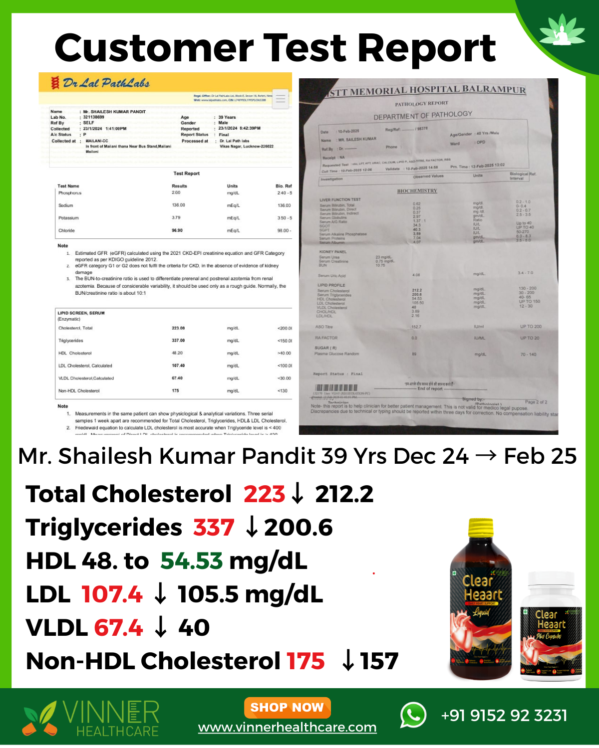 Shailesh Kumar Pandit Lab Report