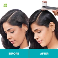 Matrix Biolage Scalppure Professional Anti-Dandruff Shampoo, 400 ml | 72 HRS Scalp Detox | Regulates Sebum | Paraben-free & Vegan | Shampoo for Men & Women