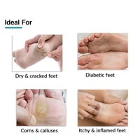 Fixderma Foobetik Cream, Foot cream, Foot care for diabetic, For Dry & Cracked Feet, Moisturizes & Soothes Feet, Heel Repair, For Calloused, or Chapped Skin, Paraben Free