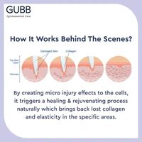 GUBB Derma Roller For Face Acne Scars, Skin Ageing & Hair Regrowth - Reduces Hair Fall | Stimulates Hair Follicles | Suitable for Beard Also | Safe & Effective - Grey