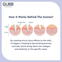 GUBB Derma Roller For Face Acne Scars, Skin Ageing & Hair Regrowth - Reduces Hair Fall | Stimulates Hair Follicles | Suitable for Beard Also | Safe & Effective - Black