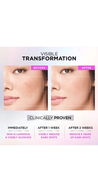 Loreal Paris Glycolic Bright Skin Brightening Serum / Dark Spots & Uneven Skin Tone  - Loreal Paris, Natural