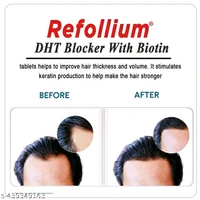 REFOLLIUM DHT Blocker With Biotin - 30 Tablets 