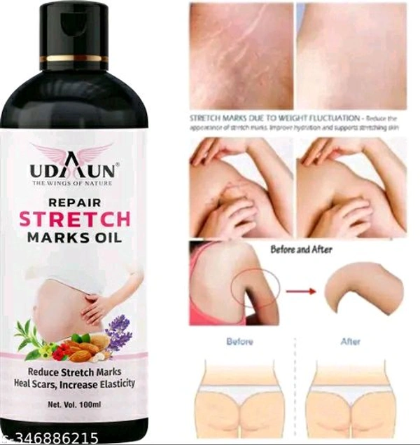 ELIBLISS Udaun Stretch Mark Removall Oil 100ml