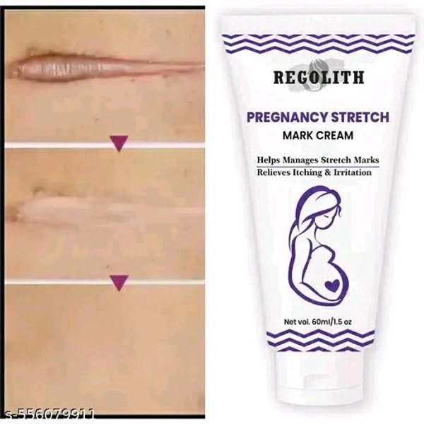 Regolith Stretch Marks Cream 60ml