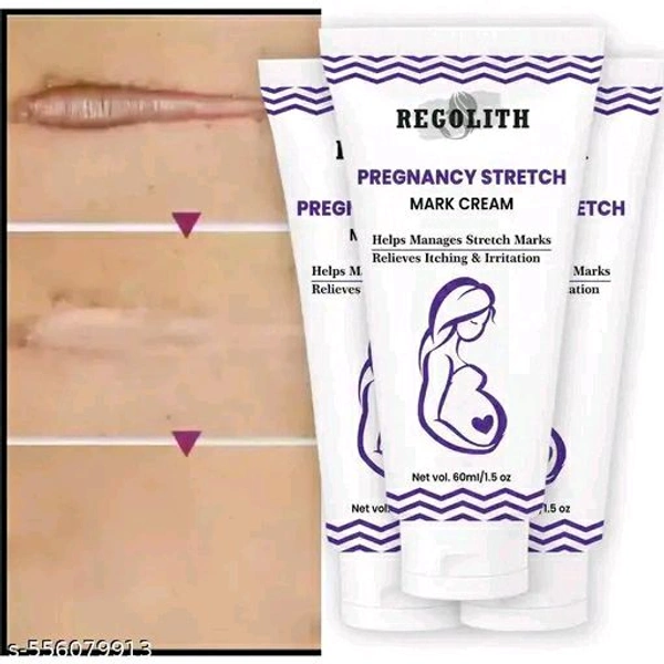 Regolith Stretch Marks Cream - Pack Of 3