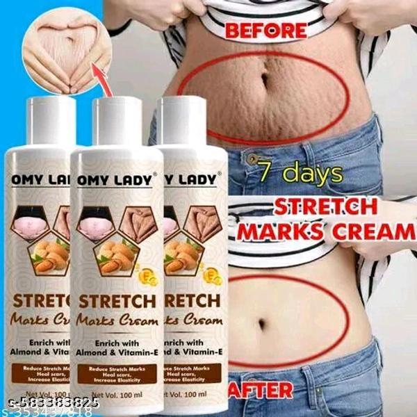 OMY LADY Repair Stretch Marks Removal 100ml - Pack Of 3