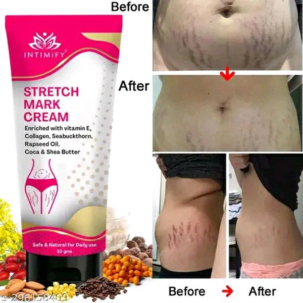 INTIMIFY Stretch Marks Removal Cream 50g