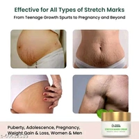 HEALOFY Advanced Stretch Marks Removal Cream 100g