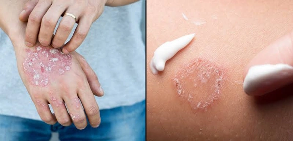Scaboma Lotion - 100ml
