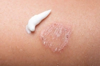 Ascabiol Lotion - 50ml