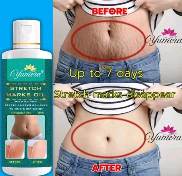 Yumora Whitening Cream