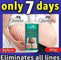 Yumora Whitening Cream