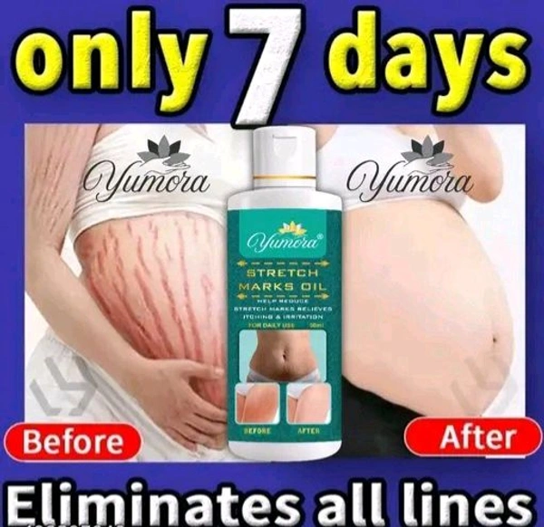 Yumora Whitening Cream