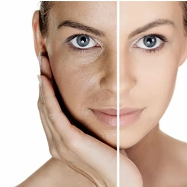 Vlcc Skin Polishing
