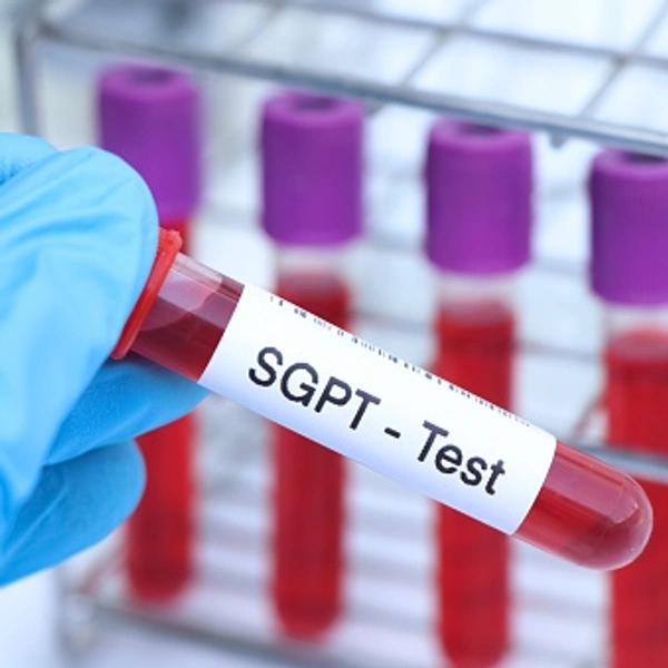 SGPT 