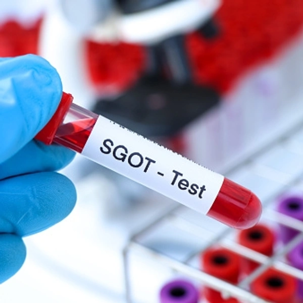 SGOT