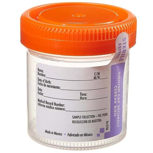 URINE M