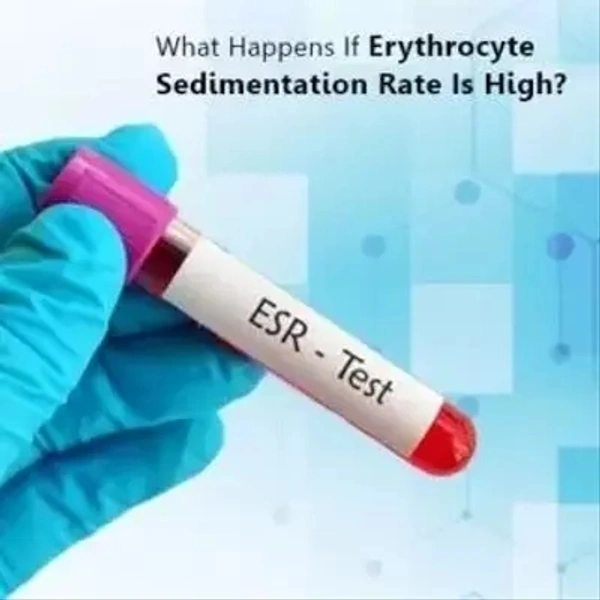 ESR