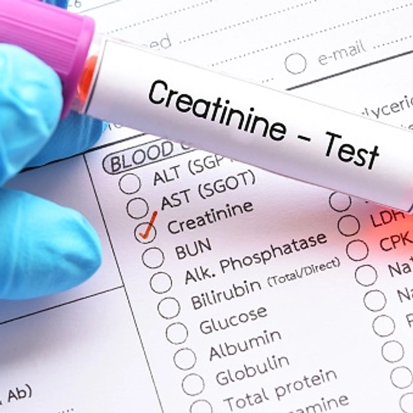 CREATININE 