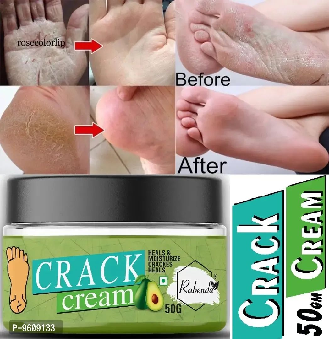 Nordic Care Foot Care Cream with Urea & Glycerin soften calluses and r