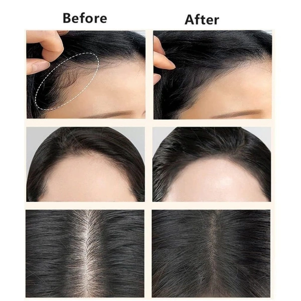 HAIR LINE POWDER BLACK, Hairline Powder Stick (Black) – Instant Root Touch-Up & Thicker Hair Look(2143)