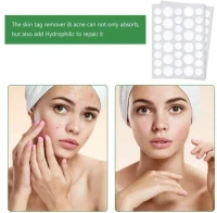 36PCS PIMPLE PATCH - "36 pcs Acne Patch Pimple Patch Beauty Products by shop99variety" (1997)