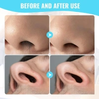 3PCS NOSE REMOVAL - "Nose Hair Remover Razor Kit  Precision Trimming Blade for Painless Grooming" (1992) - Pack of 3