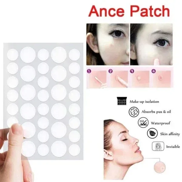 shop99variety 36PCS PIMPLE PATCH - "36 pcs Acne Patch Pimple Patch Beauty Products by shop99variety" (1997)