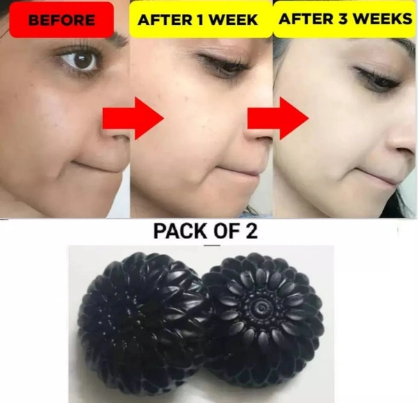 Activated Charcoal Skin Whitening Soap Pack Of 2😱