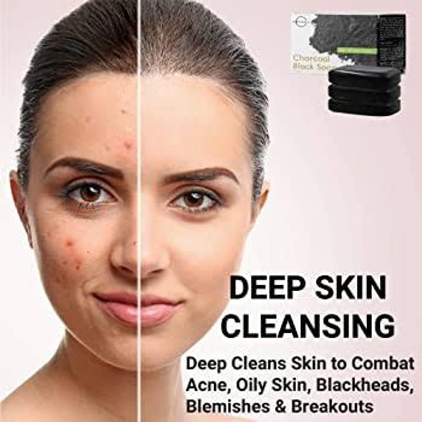 Activated Charcoal Skin Whitening Soap Pack Of 2😱