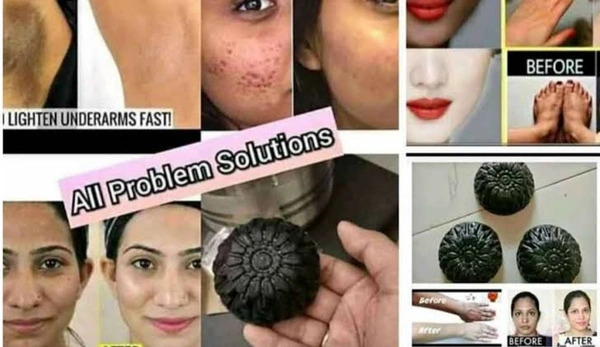 Activated Charcoal Skin Whitening Soap Pack Of 2😱
