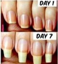 Nail Strong Growth Serum Oil💅
