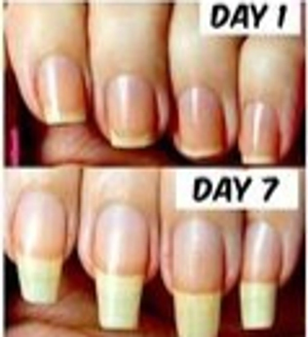 Nail Strong Growth Serum Oil💅