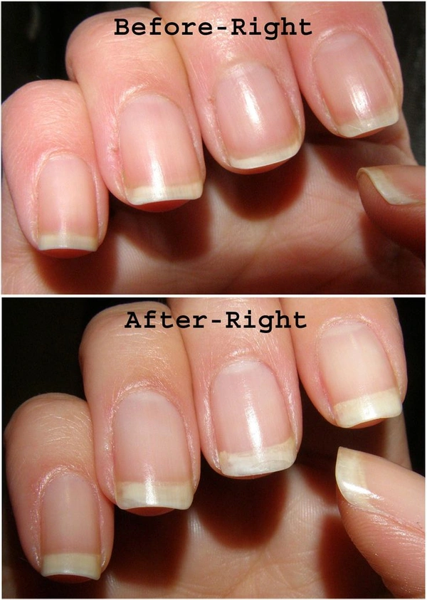 Nail Strong Growth Serum Oil💅