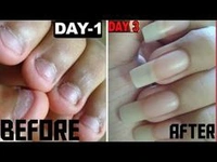 Nail Strong Growth Serum Oil💅