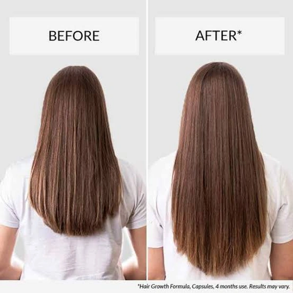 Herbal Hair Regrowth Onion Oil And Shampoo
