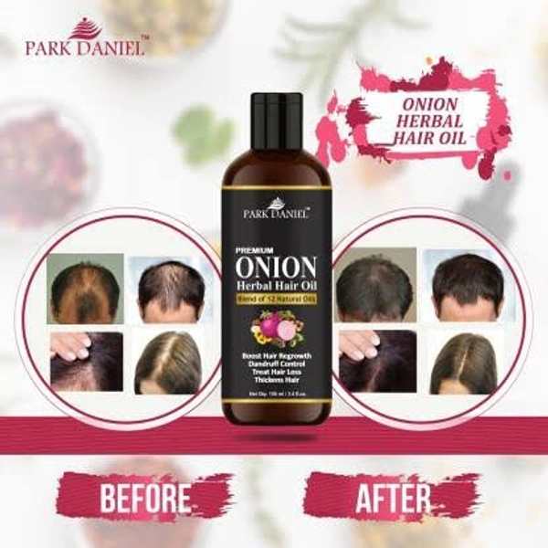 Herbal Hair Regrowth Onion Oil And Shampoo