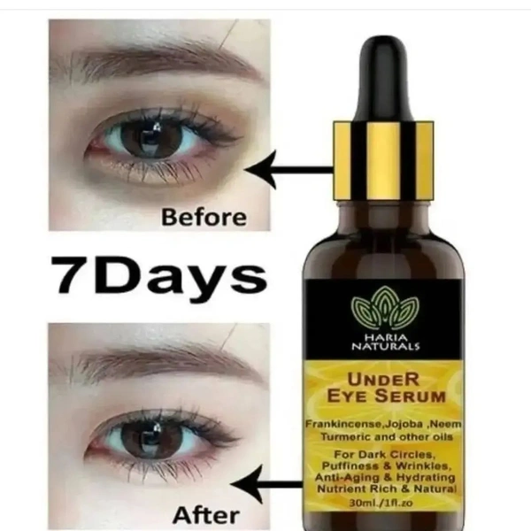 ✨Under Eye Serum For Dark Circles, Anti-Aging,Puffiness & Pure Radiant Skin*