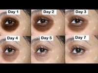 ✨Under Eye Serum For Dark Circles, Anti-Aging,Puffiness & Pure Radiant Skin*