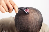 4.1 नीडल्स Derma Rollar 