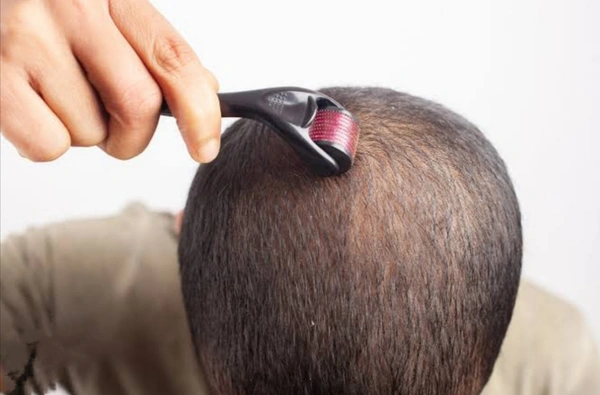 4.1 नीडल्स Derma Rollar 