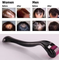 4.1 नीडल्स Derma Rollar 