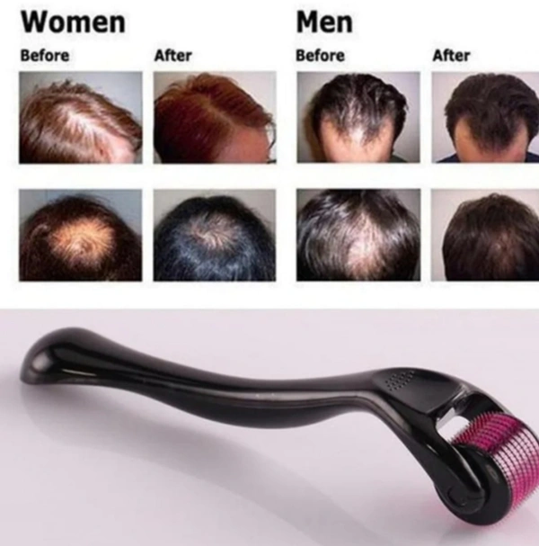 4.1 नीडल्स Derma Rollar 