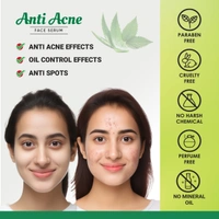 Anti Acne Face Serum - 30ml, bottle